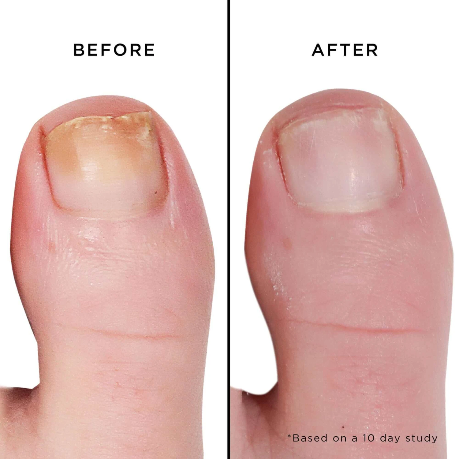 Mellow The Yellow Nail Brightening Treatment 5 Mellow The Yellow Nail Brightening Treatment - Image 3