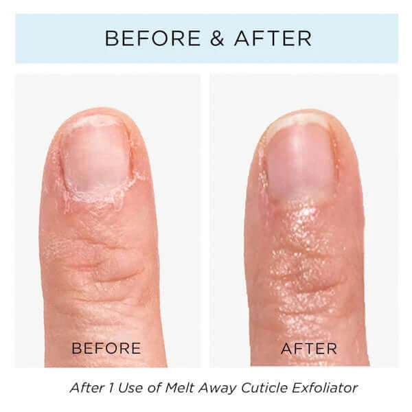 Melt Away Cuticle Exfoliator 4 Melt Away Cuticle Exfoliator - Image 2