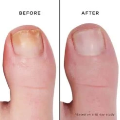 Fashion Size Mellow The Yellow Nail Brightening Treatment -Featured Cosmetics Stores mini mellow the yellow nail brightening treatment 488829