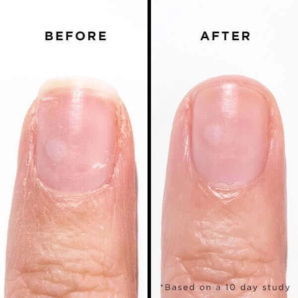 Orange Marmalade Jelly Preserve Strengthening Treatment 7 Orange Marmalade Jelly Preserve Strengthening Treatment - Image 5