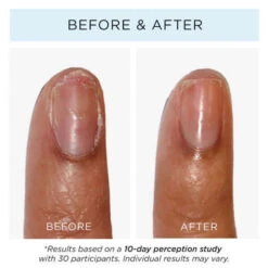 Strawberry Rhubarb Jelly Preserve Strengthening Treatment 14 Strawberry Rhubarb Jelly Preserve Strengthening Treatment -Featured Cosmetics Stores strawberry rhubarb jelly preserve strengthening treatment 332140